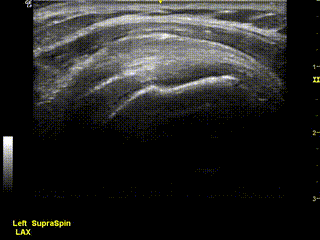 Diagnostic Ultrasound Example of a Diagnostic Ultrasound